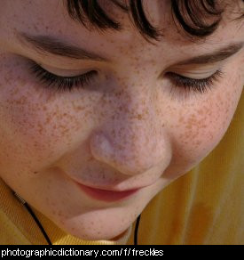 Photo of a boy with freckles