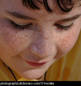 Brown Freckles