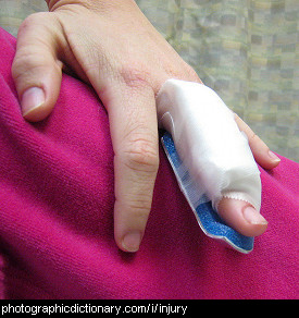 Photo of an injured finger