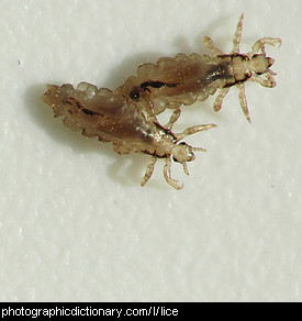 Photo of head lice