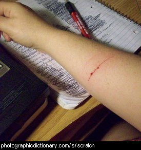 Photo of a scratched arm