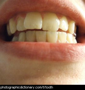 Photo of teeth
