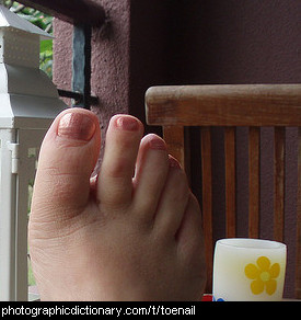 Photo of toenails
