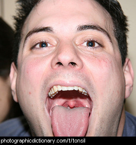 Photo of a man's tonsils