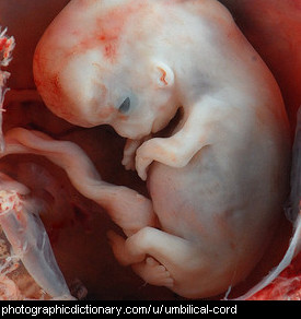 Photo of a baby with umbilical cord
