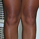 Photo of knees