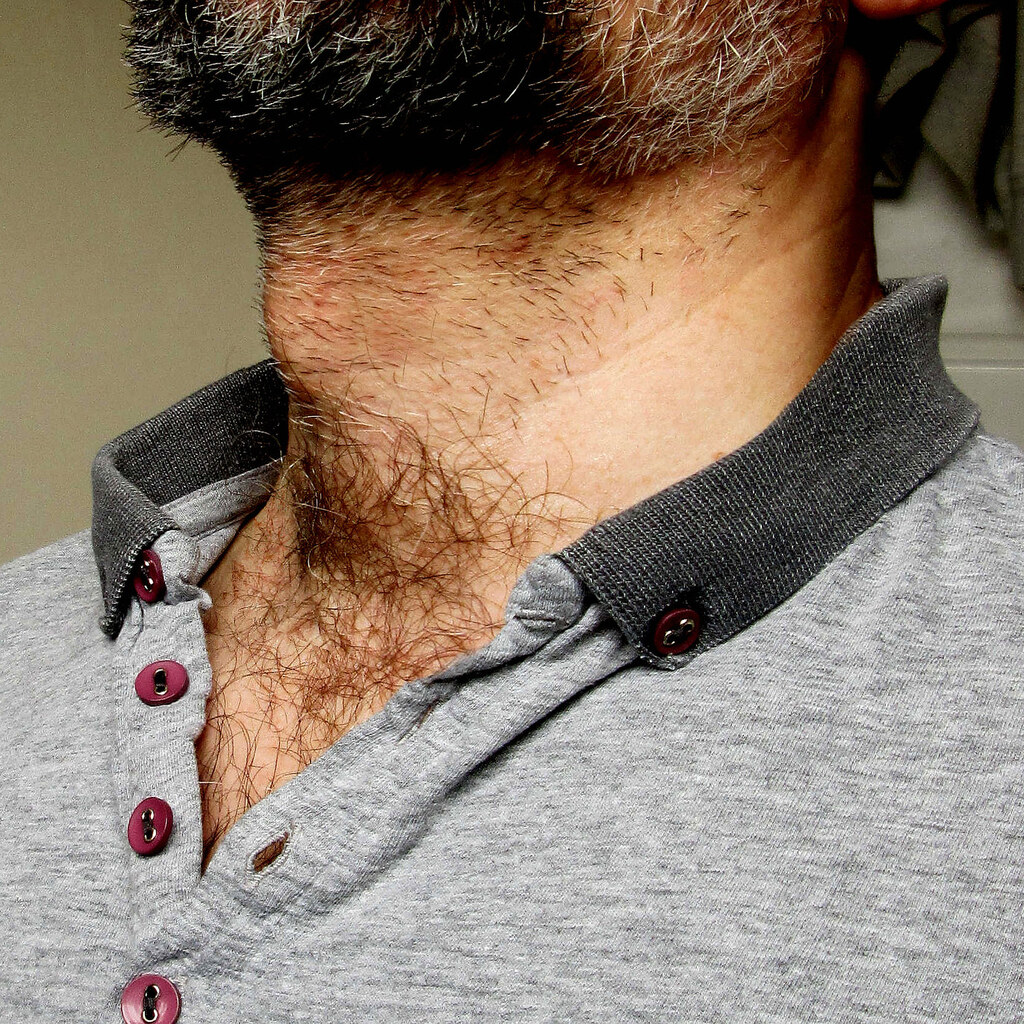 Photo of a man's Adam's apple