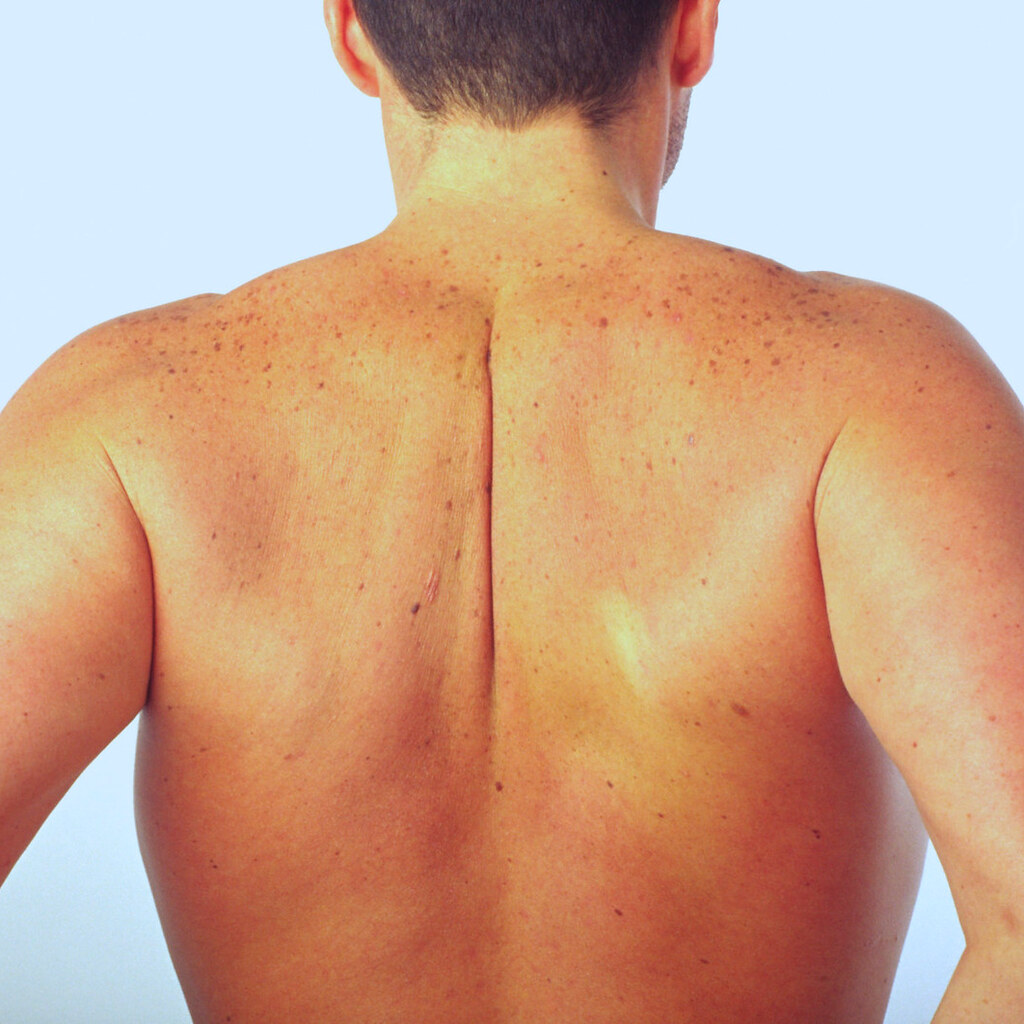 Photo of a mans back