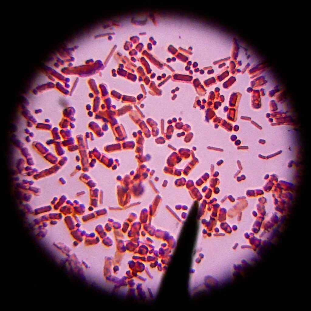 Photo of bacteria