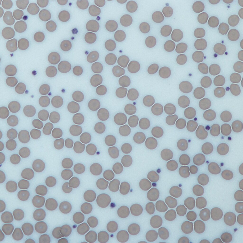 Photo of blood cells