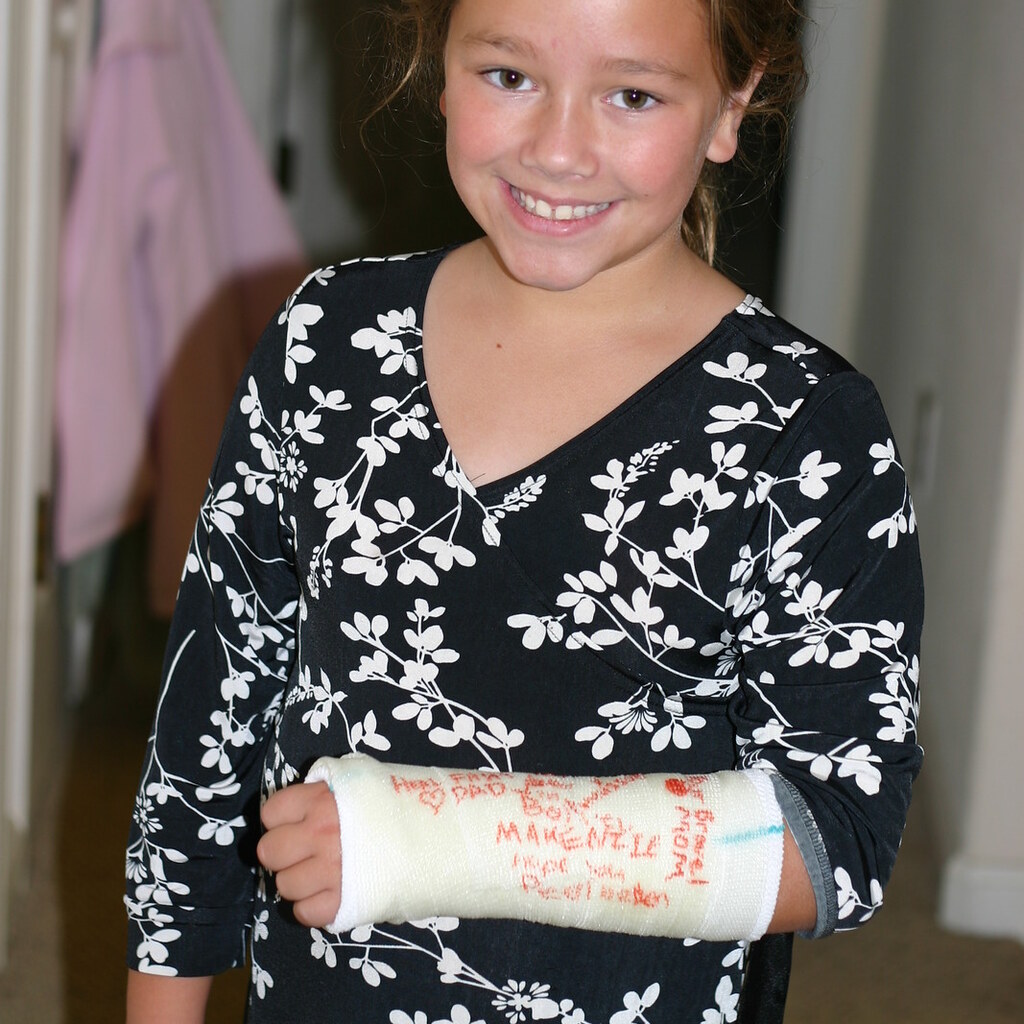 Photo of a girl with a broken arm in a cast