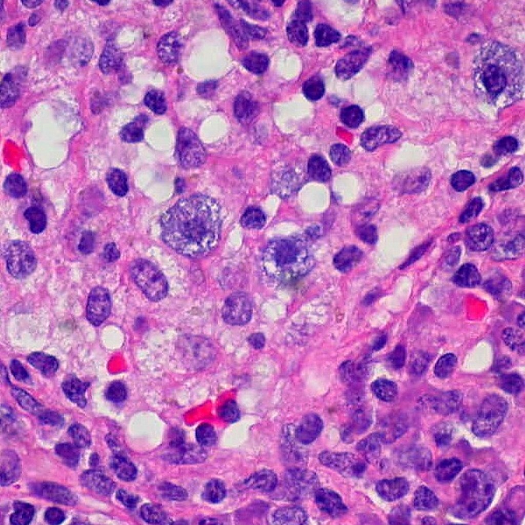 Photo of cells