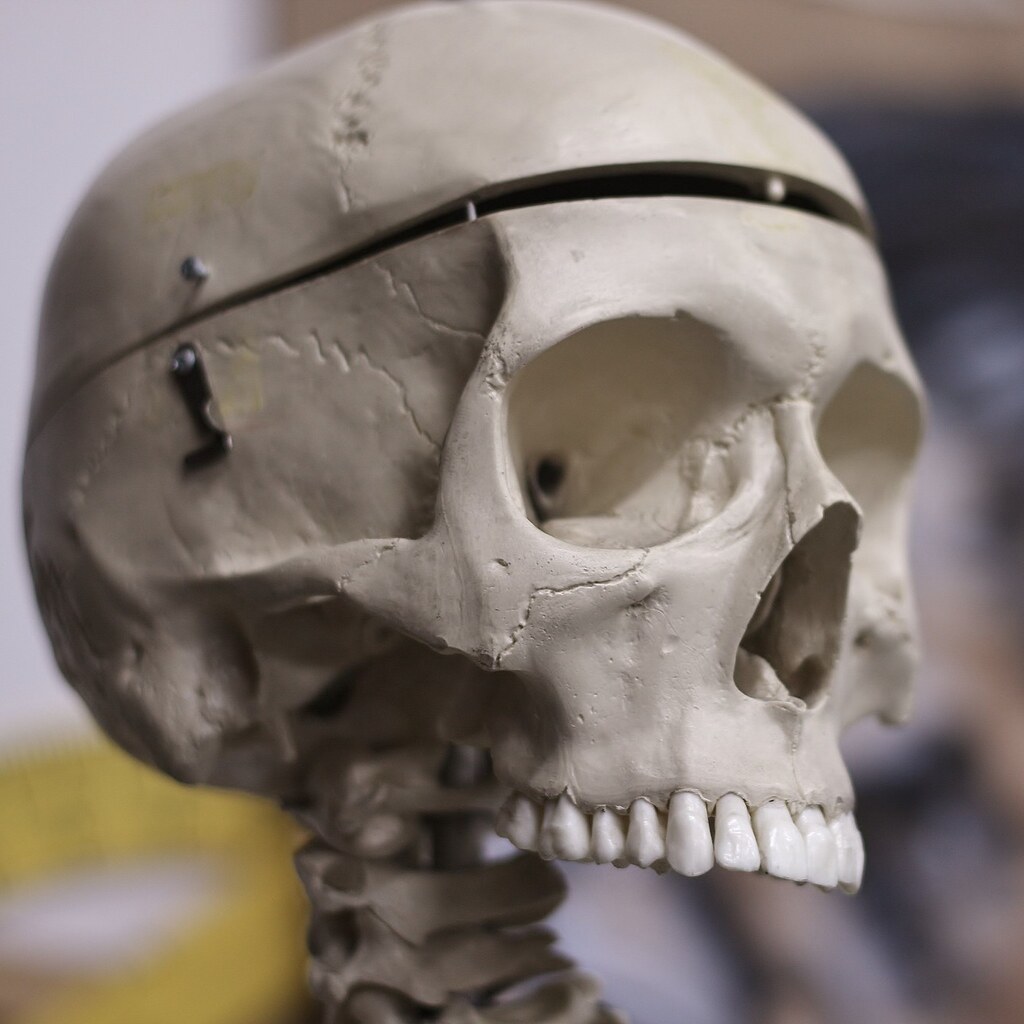 Photo of a skull with hinged cranium
