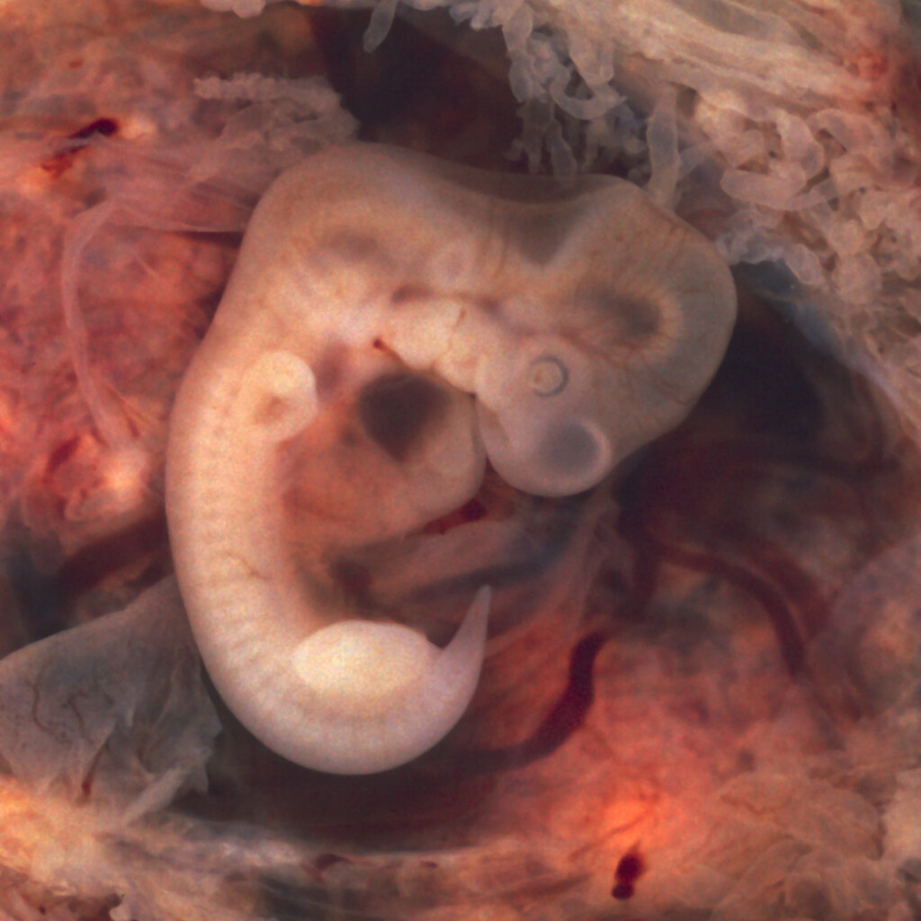 Photo of an embryo