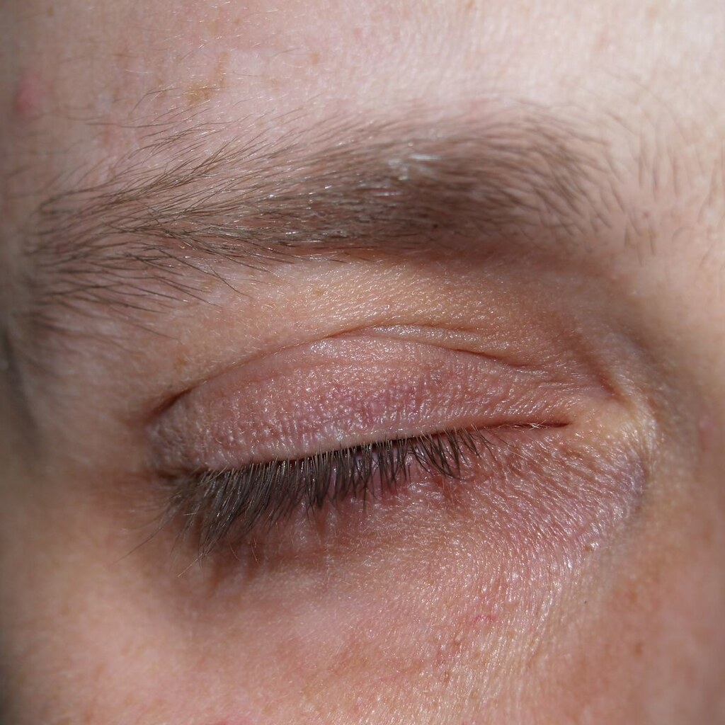 Photo of an eyelid