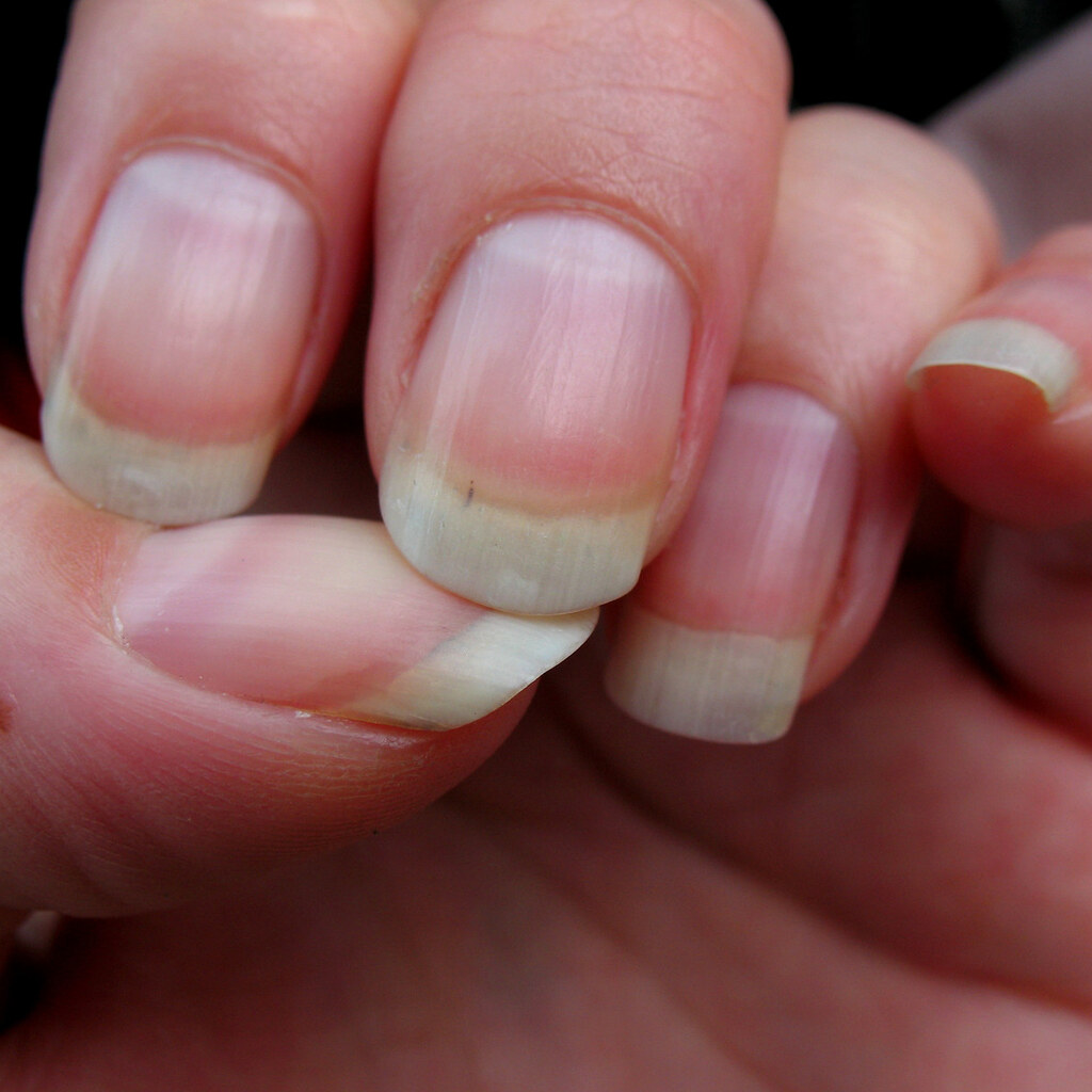 Photo of fingernails