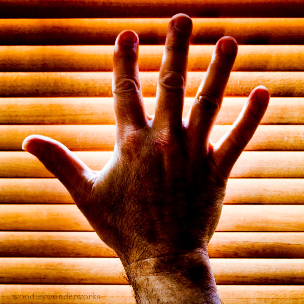 Photo of a hand holding up five fingers.