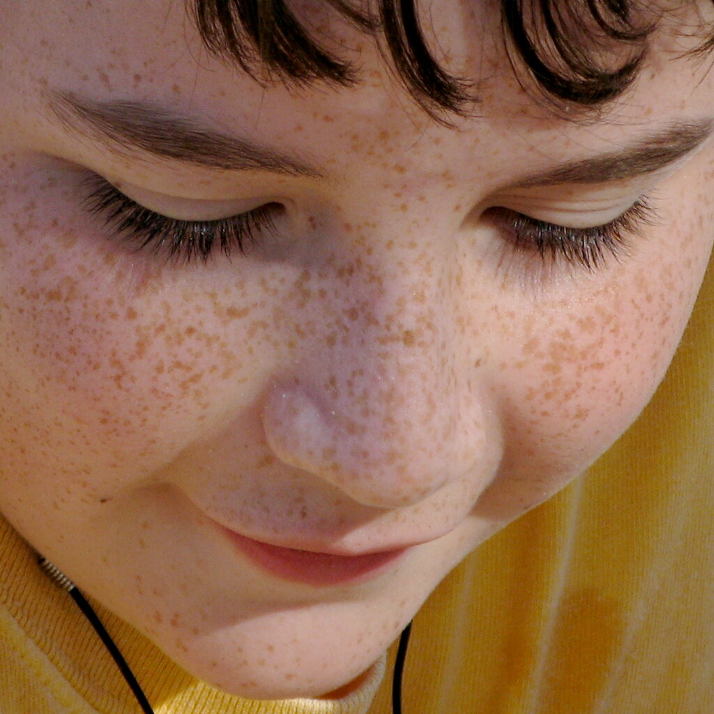 Photo of a boy with freckles