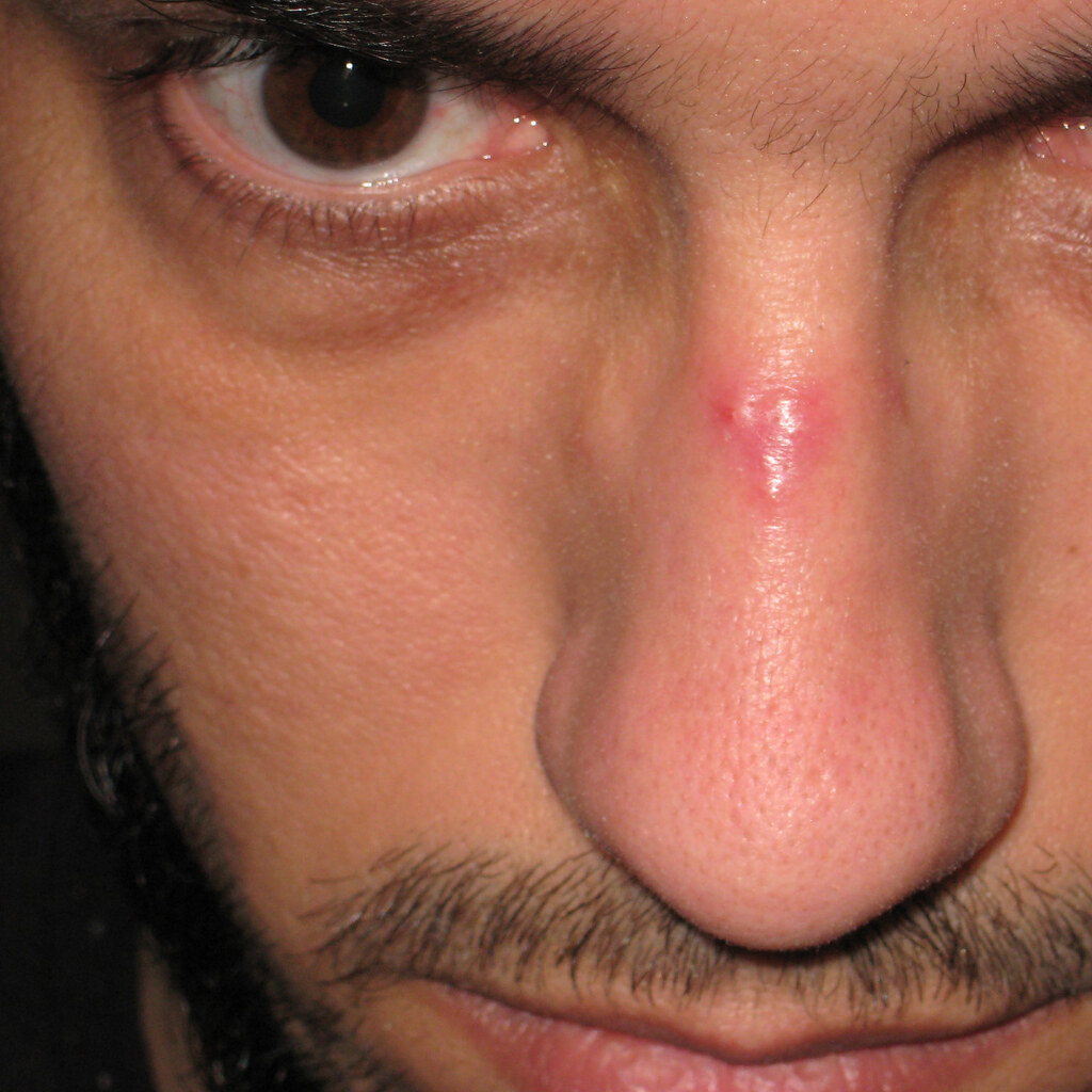 Photo of a man's nose