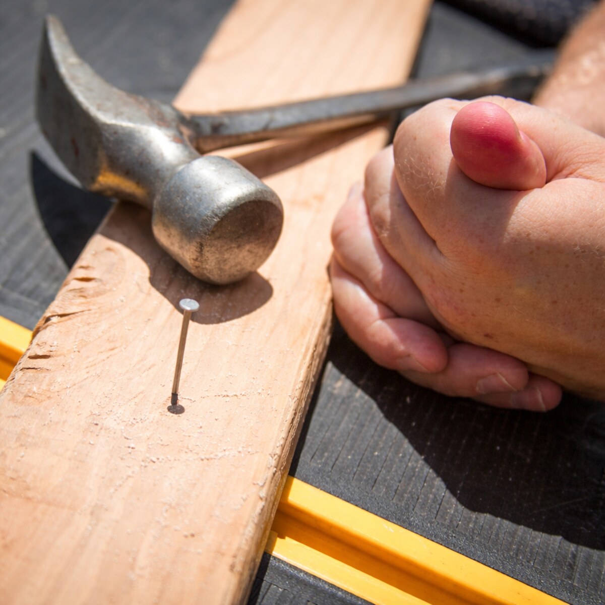 Photo of someone who hit their thumb with a hammer