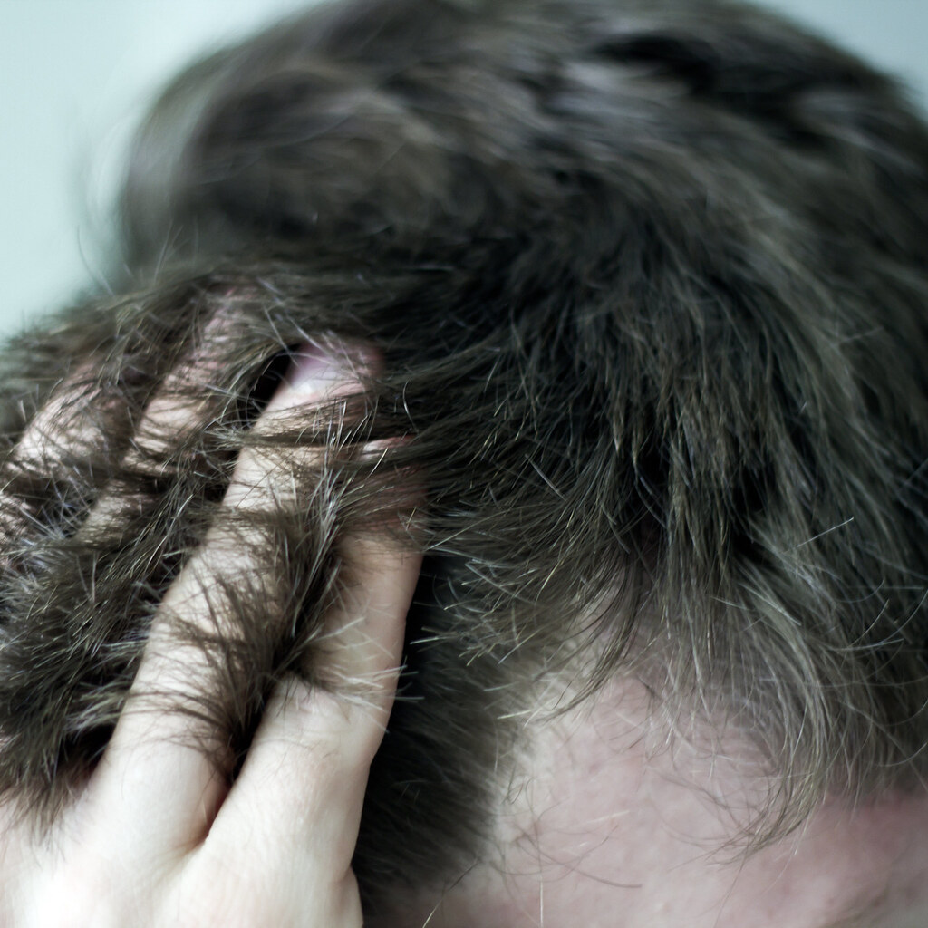 Photo of someone rubbing the top of their head