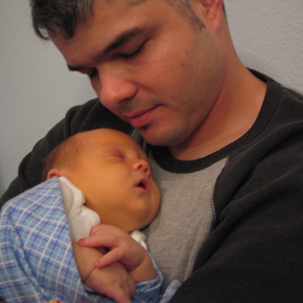 Photo of a baby with jaundice
