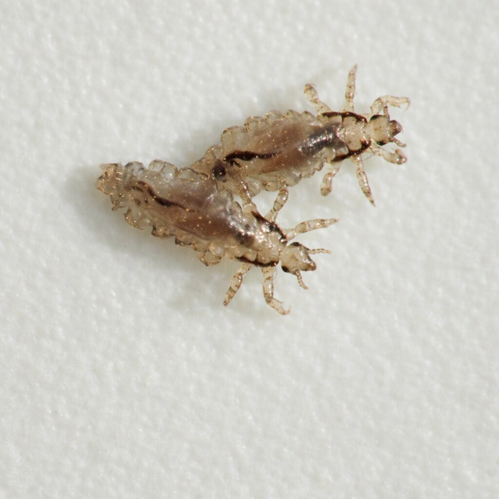 Photo of head lice