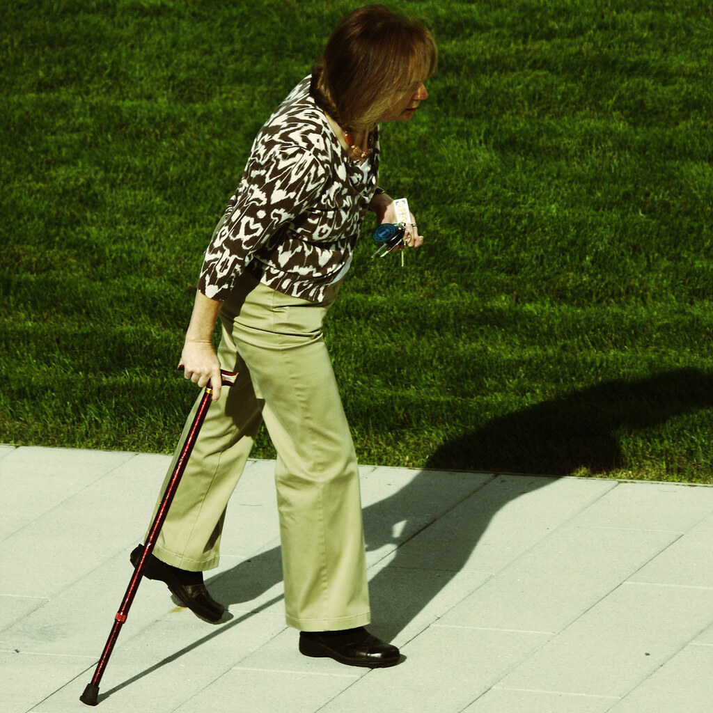 Photo of a woman limping