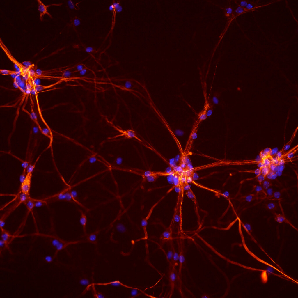 Photo of mouse neurons