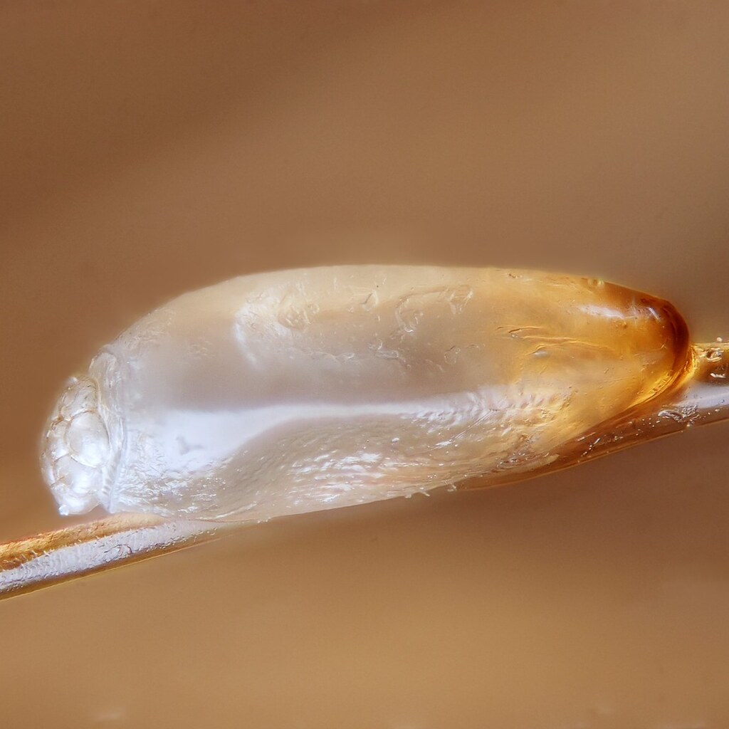 Photo of nits