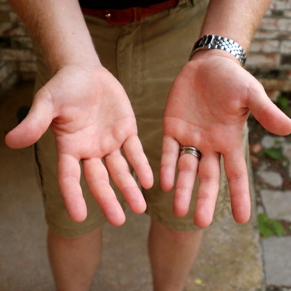 The palm of your hand.