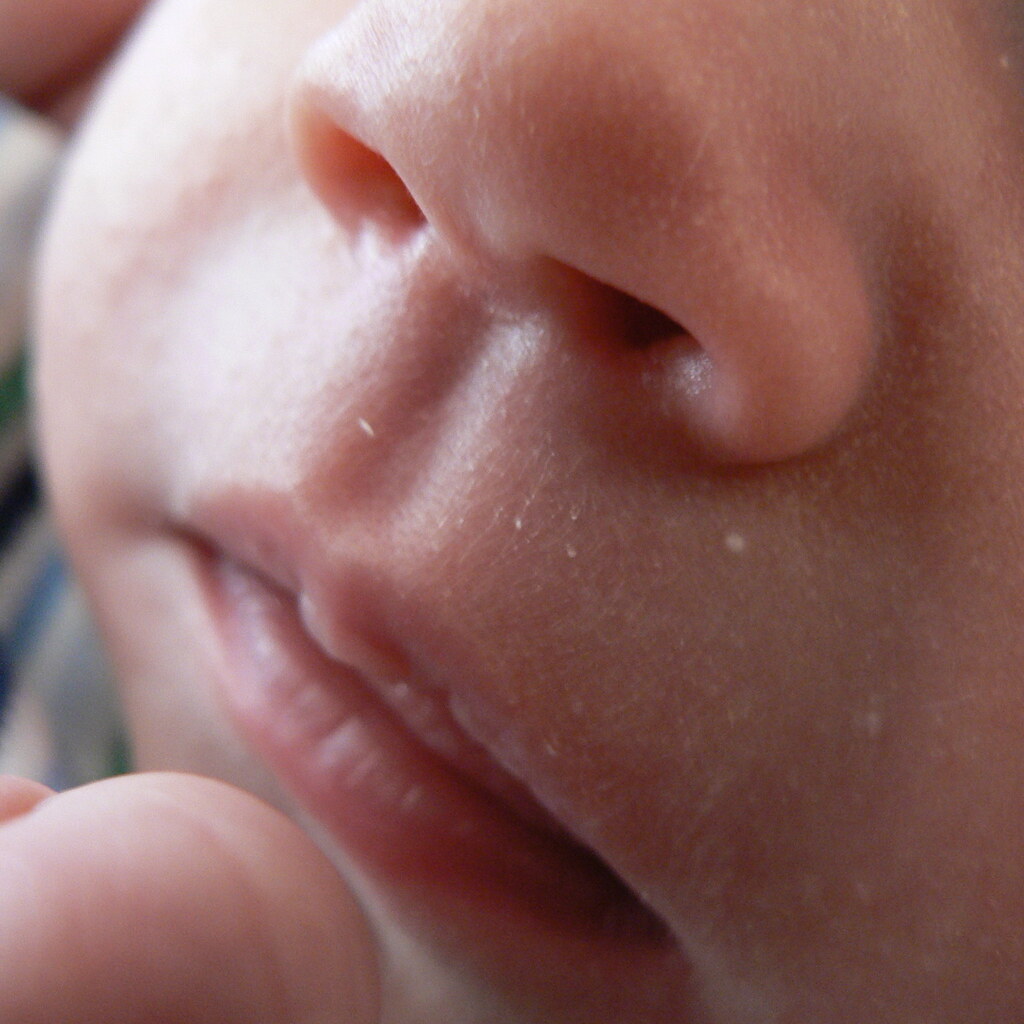 Photo of a baby's philtrum
