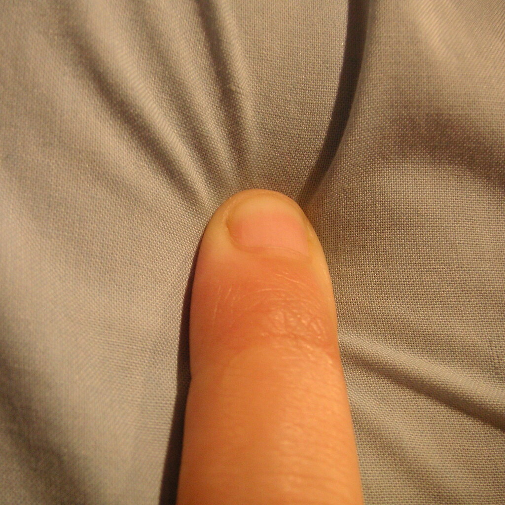 Photo of a poking finger