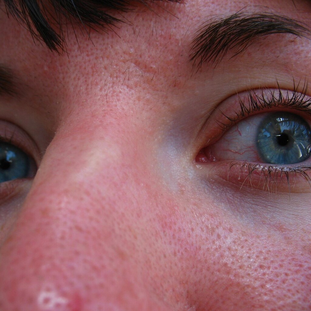 Photo of skin pores