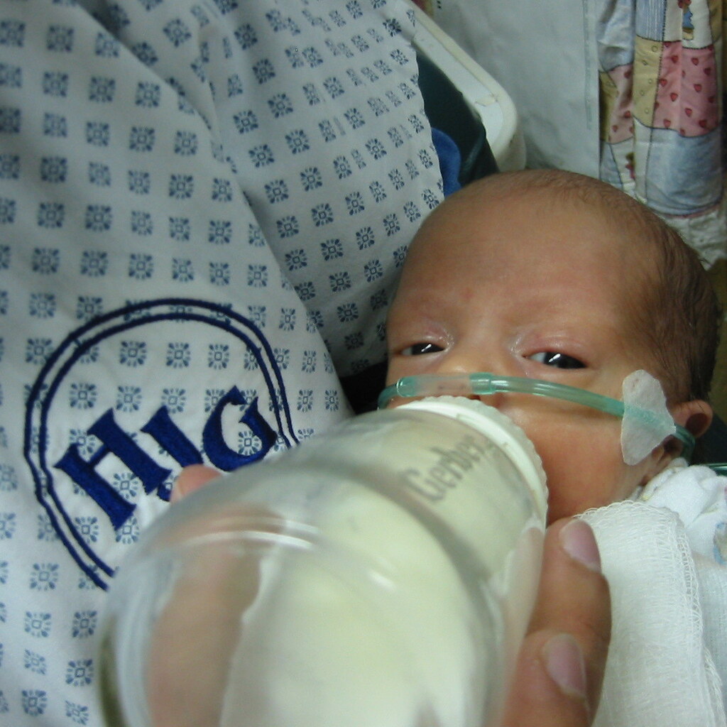 Photo of a premature baby