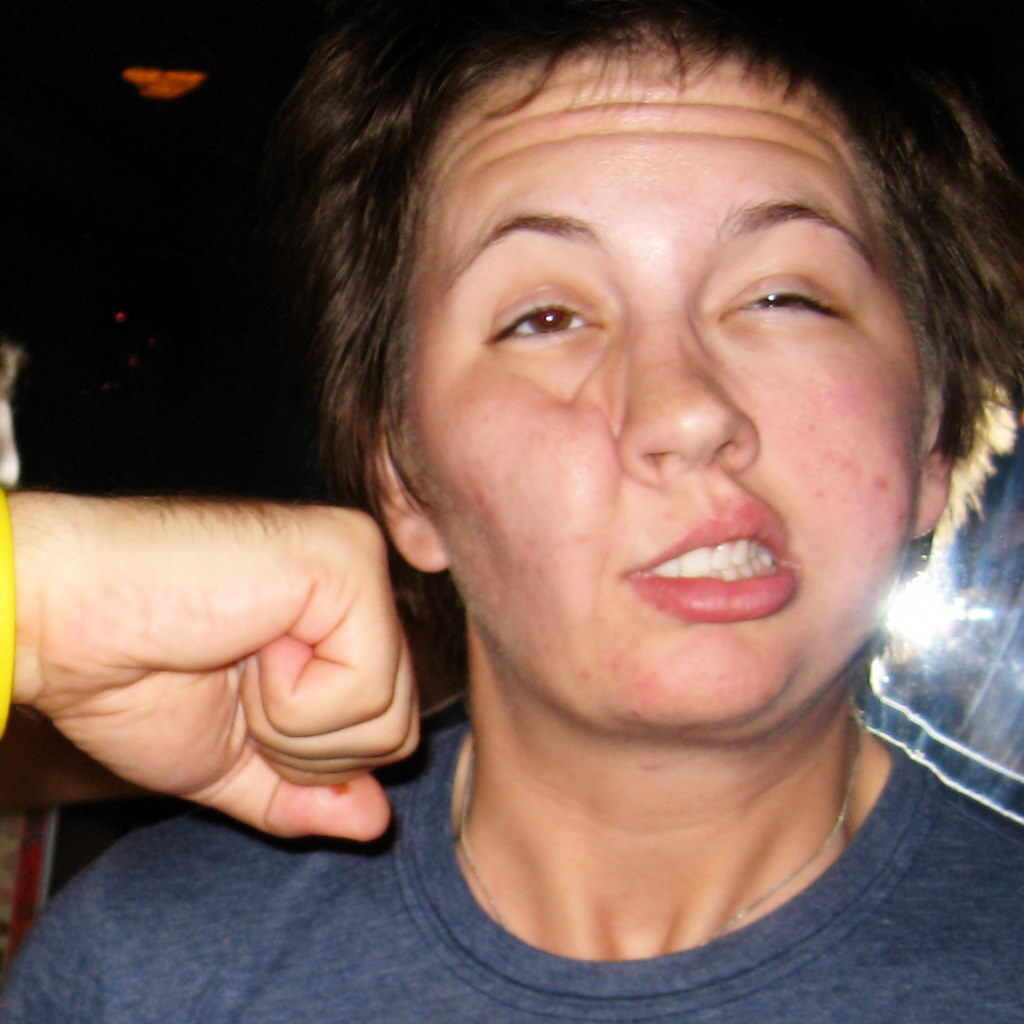 Photo of someone being punched.