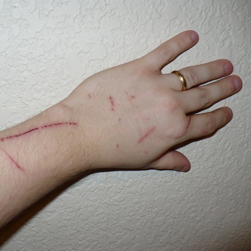 Photo of a scratched arm