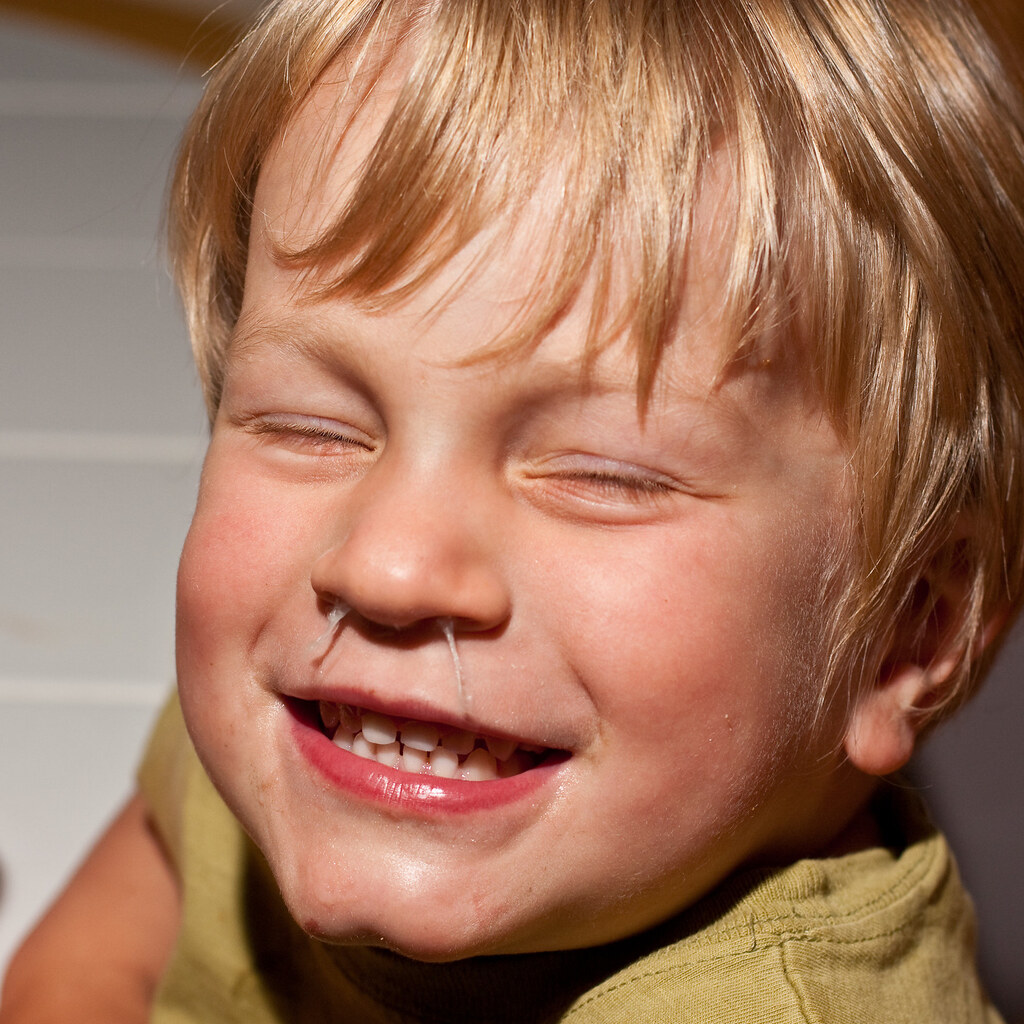 Photo of a snotty nose