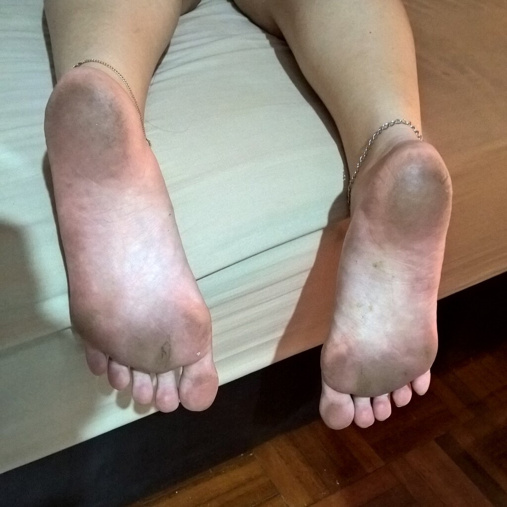 Photo of the soles of some feet.