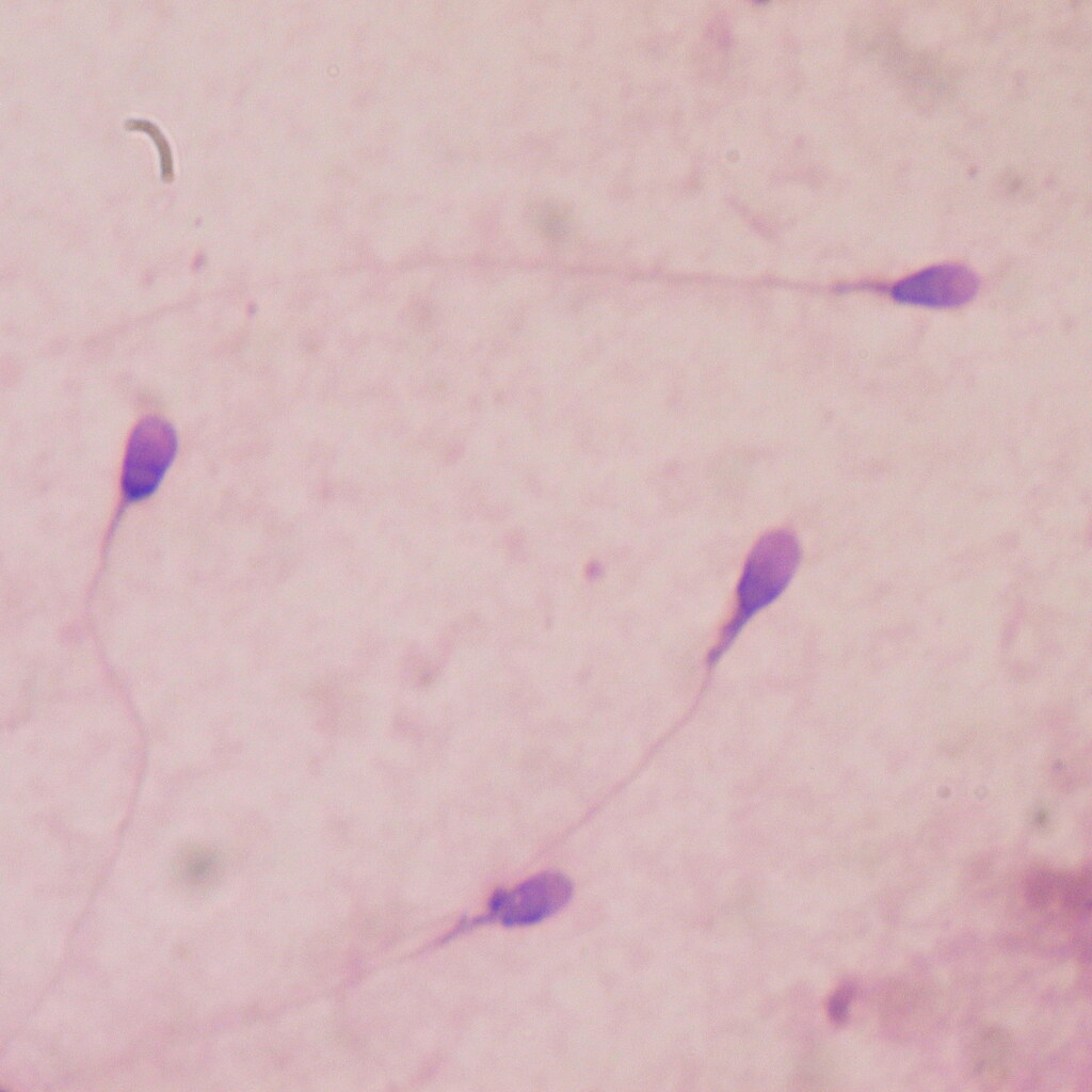 Photo of stained sperm cells