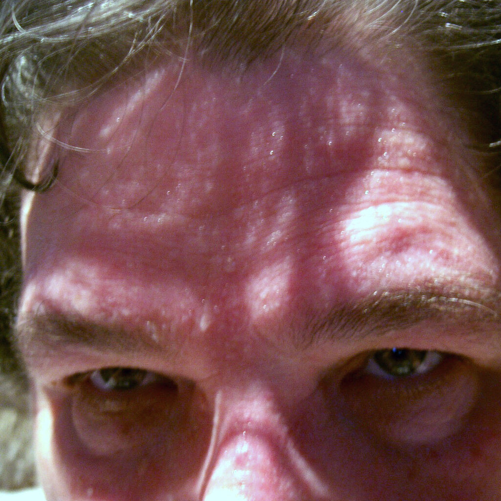 Photo of a sweaty forehead