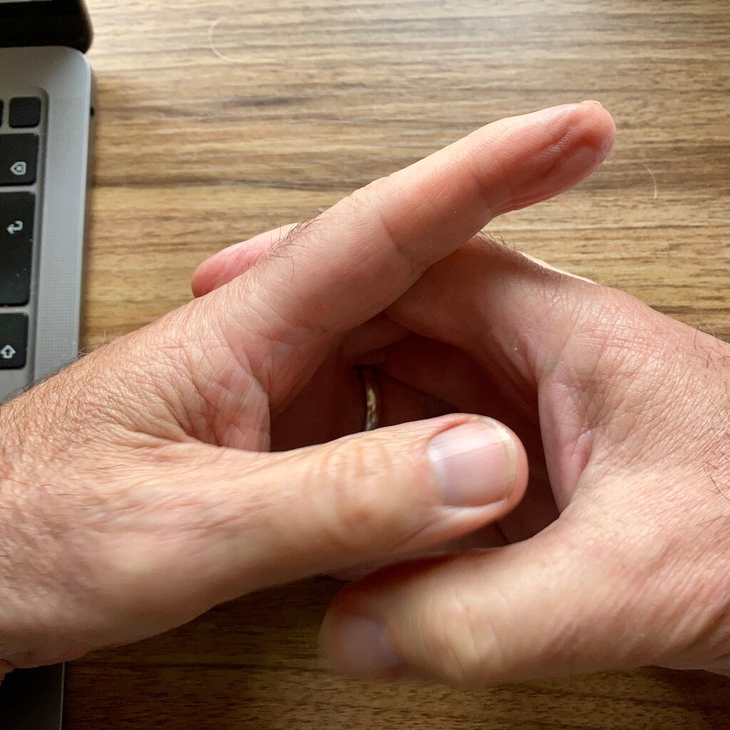 Photo of someone twiddling their thumbs