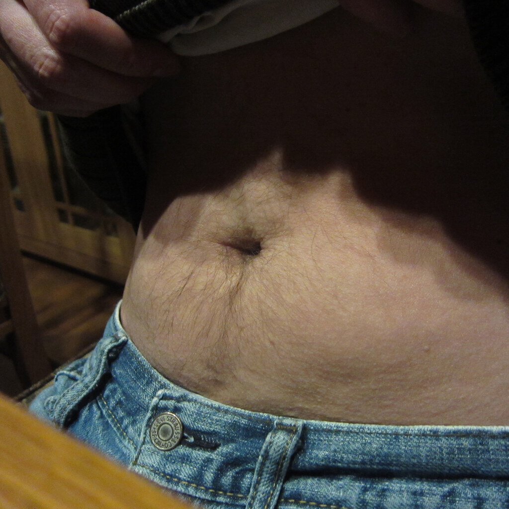 Photo of a man's umbilicus