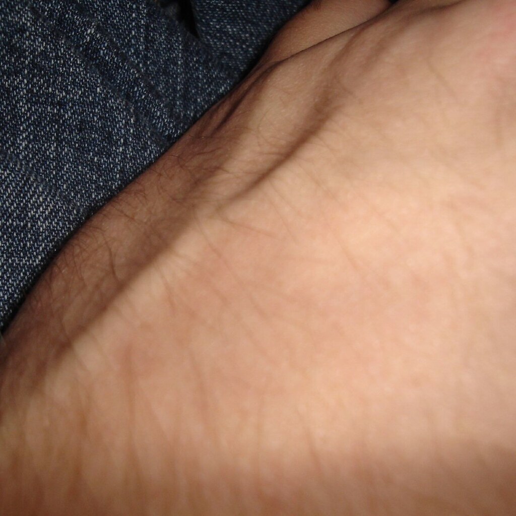 Photo of veins on an arm